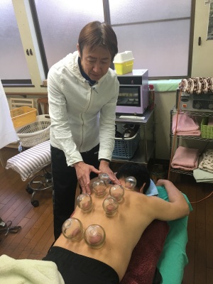 針治療